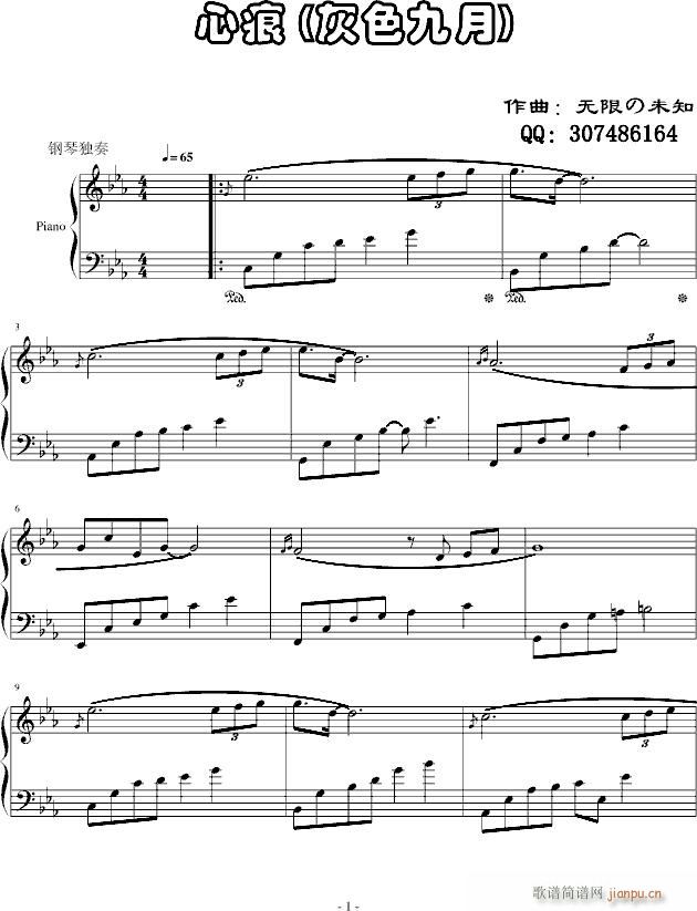 ĺ(V)1