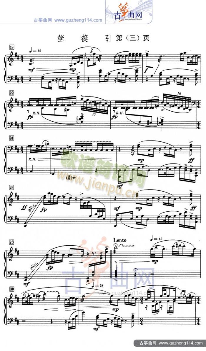 (Ź~PV)3