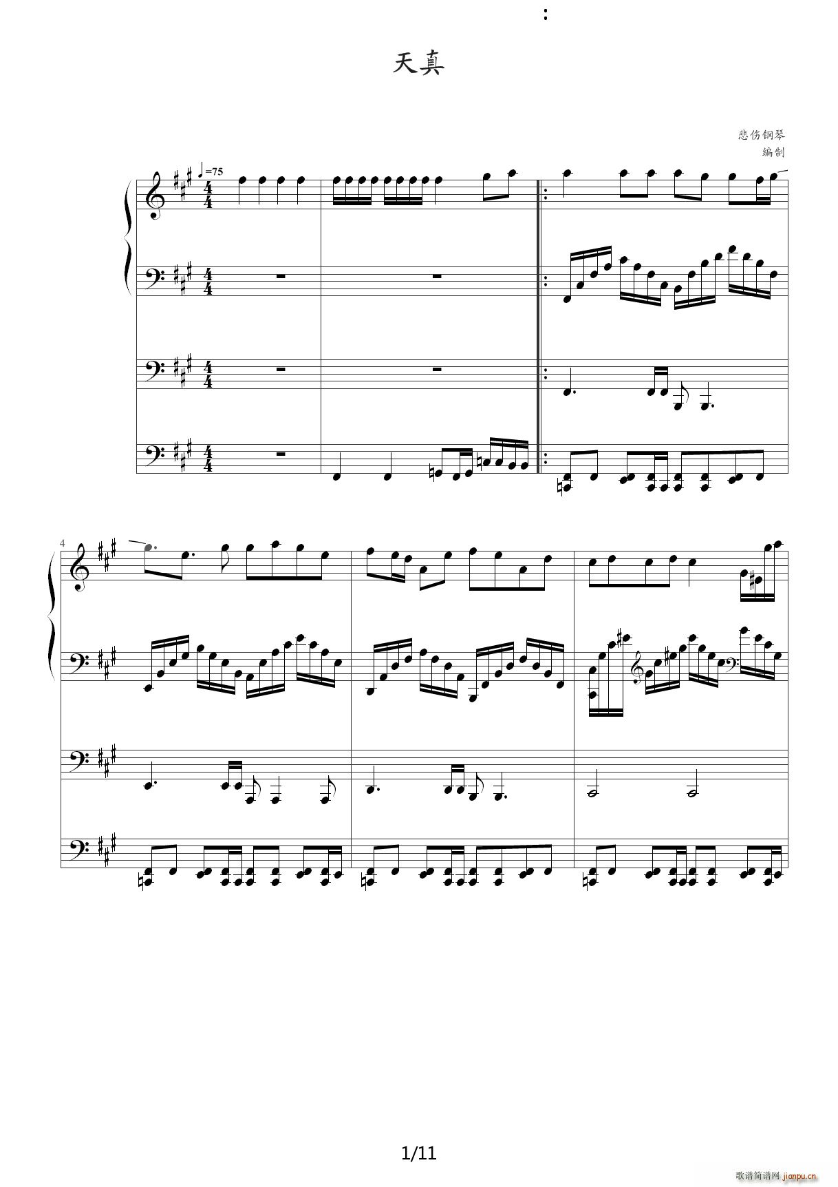  A{(V)1