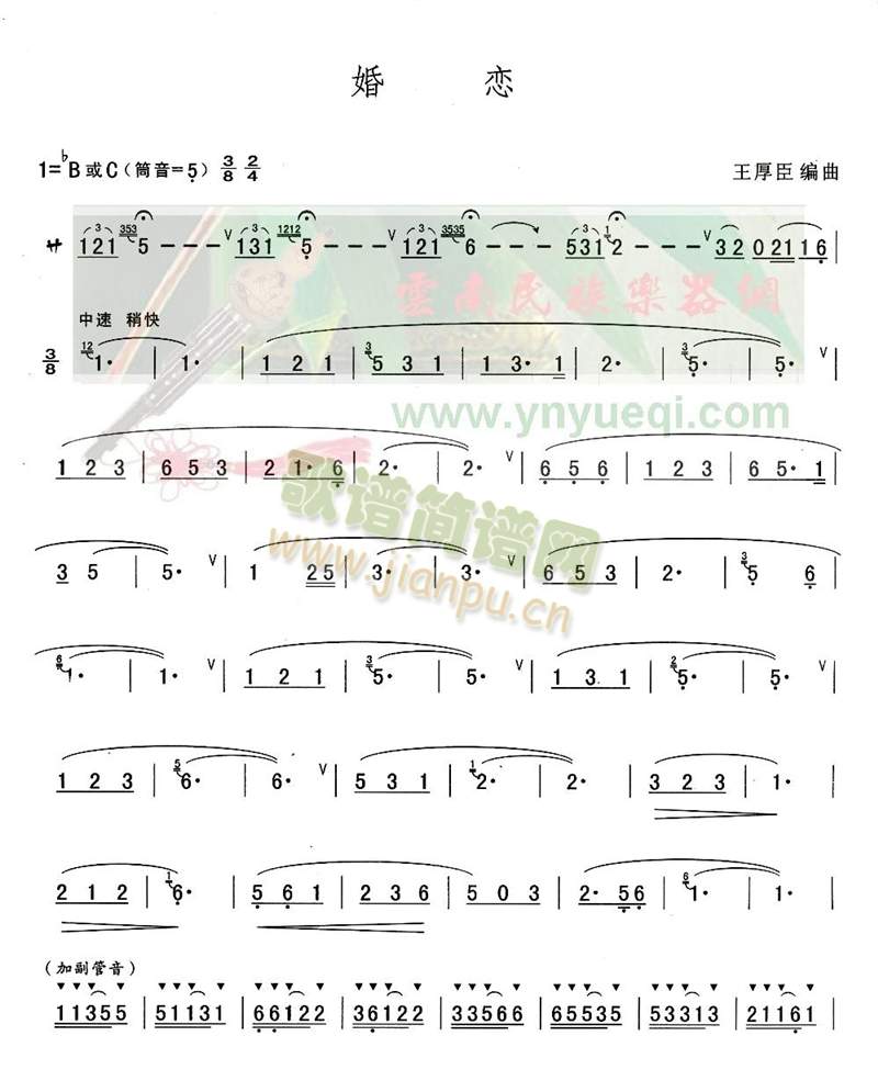 (JzV)1