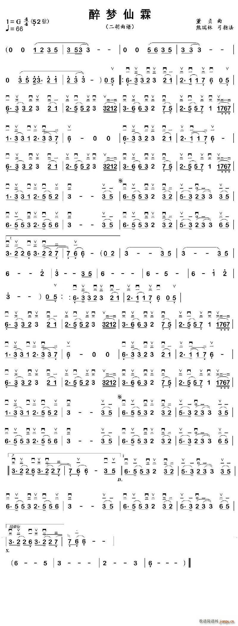(mng)ض(V)1