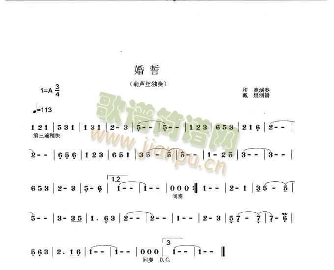 (JzV)1