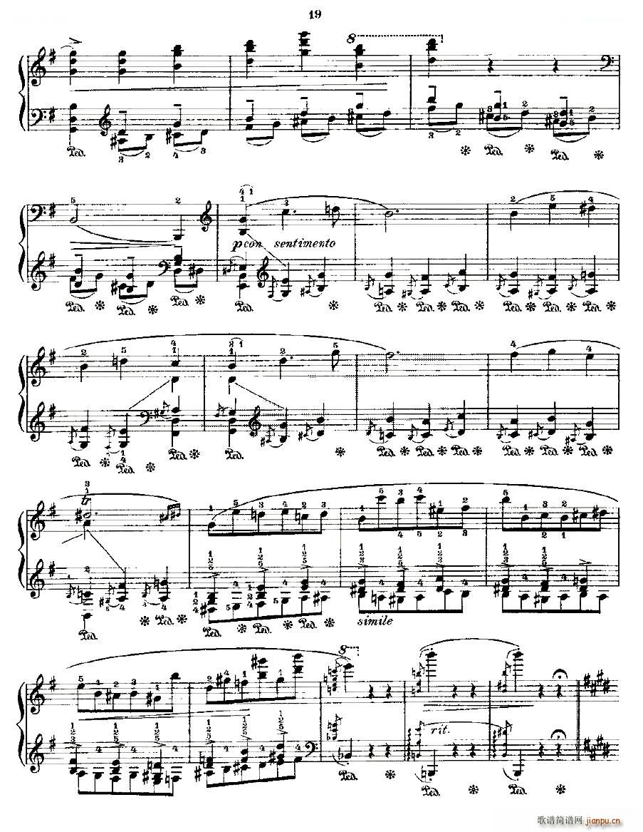 Ф  Fr Chopin Op 25 No5 1(V)3